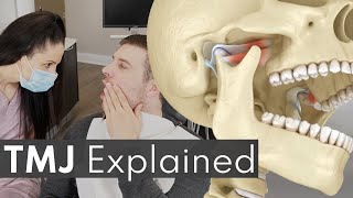 TMJ Explained  Jaw Pain Causes amp Symptoms [upl. by Sev]