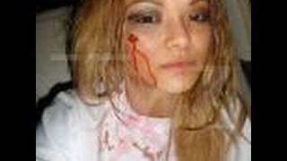 Tila Tequila Attacked at A insane clown posse Concert at The Gathering Of The Juggalos News [upl. by Merla]