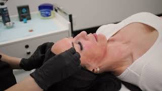 Perfect Derma Peel with Rayna No Dialogue [upl. by Daenis]