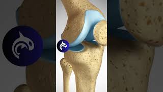 See how an ACL is reconstructed using a Hamstring Tendon Graft  3D Animation knee kneeinjury [upl. by Nahtaj]