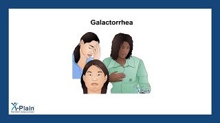 Galactorrhea [upl. by Anirok]