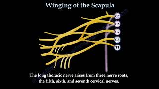 WINGING OF THE SCAPULALONG THORACIC NERVE  Everything You Need To Know  Dr Nabil Ebraheim [upl. by Noyk]