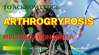 Arthrogryposis Multiplex Congenita  Natural Remedies [upl. by Soneson]