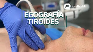 Ecografía Tiroidea  Cervical Antofagasta  ECONORT [upl. by Adnauqahs]