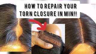 😳How to fix your torn closure wig at home diy closure hacks wigtutorial sensationnelhair [upl. by Celeski]