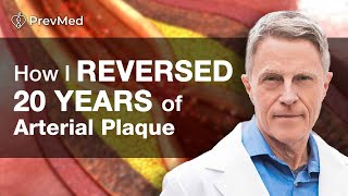 How I Reversed 20 years of Arterial Plaque [upl. by Ecidnak]