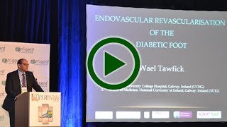 PRESENT Podiatry  Endovascular Revascularization of the Diabetic Foot [upl. by Neira]