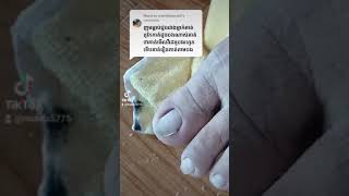 Clean clients dirty toenail and return with healthy feet nail​​​ asmr fyp ear shorts viral [upl. by Francene]