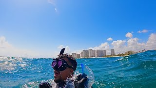 Florida man gets stung by Portuguese Man O’ War [upl. by Areid]