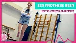 WAT ALS 1 BEEN VEEL KORTER IS DAN DE ANDERE  TOPDOKS EXTRA [upl. by Eromle]