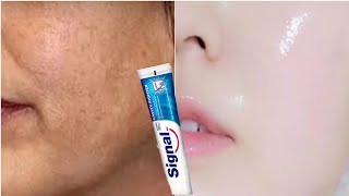 Utilisez du dentifrice pour éliminer la pigmentation et le mélasma et blanchir la peau [upl. by Anoynek157]