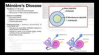 👂 Ménière’s Disease  Presentation Pathophysiology Diagnosis amp Treatment [upl. by Supmart245]