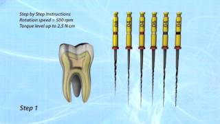 HYFLEX CM Key Features [upl. by Ttesil]