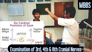 Examination of 3rd 4th amp 6th Cranial Nerves  MUHS  mbbs neetpg practical medicine cns [upl. by Elrem]