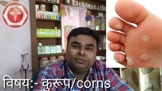 कुरूपगोखरू आहेत पायाला मग पहाचcorns treatment by Dr sachchidanand pardeshi [upl. by Gnoz]