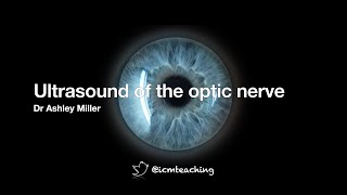 Optic nerve ultrasound [upl. by Obelia360]