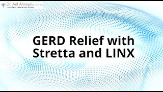 The Pros and Cons of Stretta vs Linx for GERD [upl. by Namdor]