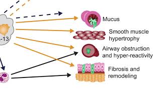 The Potential of Novel Biologic Therapies in Managing Chronic Rhinosinusitis With Nasal Polyps [upl. by Arehsat654]