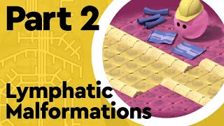 What are Lymphatic Malformations Lymphatic System Part 2 [upl. by Aldon433]