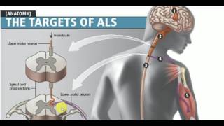 MEDICINE LECTURES  Neurology  AMYOTROPHIC LATERAL SCLEROSIS [upl. by Carolann608]