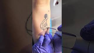 SCAR FREE TATTOO REMOVAL ep7 short [upl. by Enitsenrae]