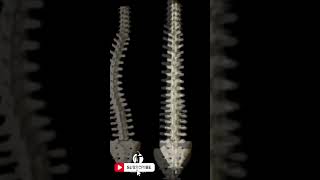 Understanding Scoliosis  A Curvature Worthy of Attention [upl. by Epilihp789]