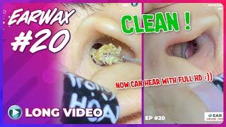 EP 20 Earwax ASMR This is how I clean and clear my customers ears [upl. by Nahgeem]