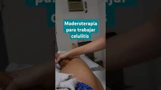 Maderoterapia masajes celulitis [upl. by Barbabas]