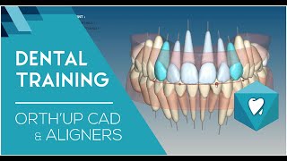 Logiciel CAD dOrthodontie pour aligners  Dental Training about French Align Technology with OrthUp [upl. by Vern120]