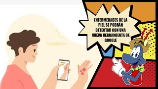 Enfermedades dermatológicas podrán ser detectadas con Google HormigaTV [upl. by Annaihs]