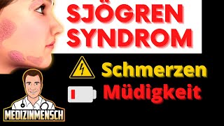 Schmerzen amp Bleierne Müdigkeit Den Ganzen Tag 😴 POLYNEUROPATHIE beim Sjögren Syndrom Arzt erklärt [upl. by Arianna627]