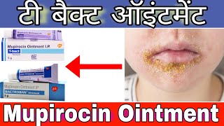 T bact ointment  Bactroban ointment  Mupirocin ointment uses dose sideeffects  T bact use [upl. by Sarilda]