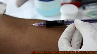 बल्ड कलेक्शन का आसान तरीका Blood collection technique Blood sample collection procedure [upl. by Odlavso]