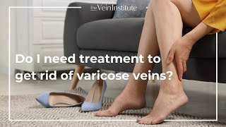 Treatment vs AtHome Care for Varicose Veins [upl. by Tamas]