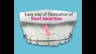 How To Make Labial Bow  Easy Method  Hawleys Retainer  labialbow drrajnibaladentacamallab2234 [upl. by Adeline895]