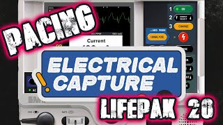 Stat Skills Transcutaneous Pacing Using the LifePak 20 [upl. by Egarton690]