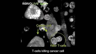 T cells killing Cancer Cell science biology [upl. by Eadnus965]