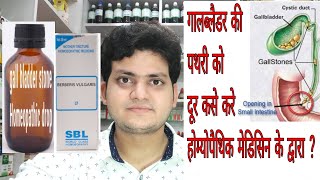 Gall bladder stone  Homeopathic medicine for Gall bladder stone  Explain [upl. by Symer]