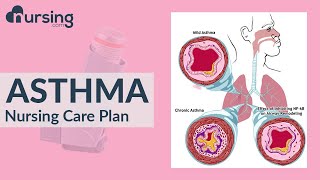 How to care for a patient with Asthma  Asthma Treatment  Nursing care plan [upl. by Urbannal]