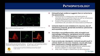 Indications Cervical Spondylotic Myelopathy  Benjamin Kafka MD [upl. by Pancho]