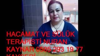 NURAN KAYNAR HACAMAT VE SÜLÜK TERAPİSTİ KAYSERİ [upl. by Melloney]