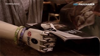 Medical amp Lab Equipment  Prosthetics bebionic [upl. by Sixel]