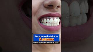 Remove Teeth Stains in 5 mintutes Dr Srishti Bhatia smilemakeover [upl. by Ettesil]