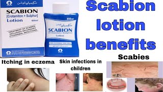 Scabion lotion uses and benefits  How to use scabion lotion  complete review in urdu hindi [upl. by Dekeles]