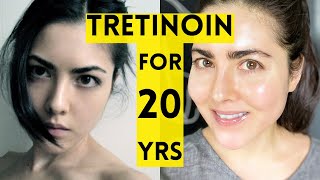 20 Year Results of Using Tretinoin [upl. by Aneloaup]