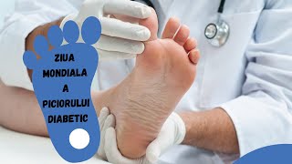 Diabetul Zaharat 10 Sfaturi ca sa NU Ajungi la Amputatie [upl. by Krug780]