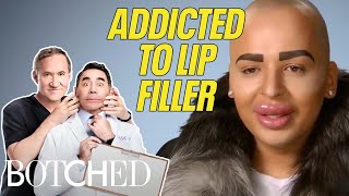 5 BOTCHED Lips Illegal Injections Filler Addictions and Freak Accidents  Botched  E [upl. by Iviv949]