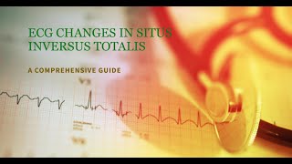 Deciphering ECG Patterns in Situs Inversus Totalis A Cardiological Analysis [upl. by Ebeohp298]