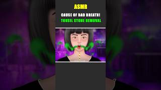 ASMR Bad Breath Tonsil Stone Removal Animation asmr animation shorts [upl. by Aneleve]