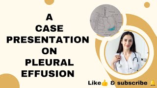 case presentation on pleural Effusion pleuraleffusion casepresentation subscribe nursingstudent [upl. by Jacynth895]